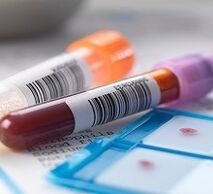 Diagnosis of laboratory prostatitis