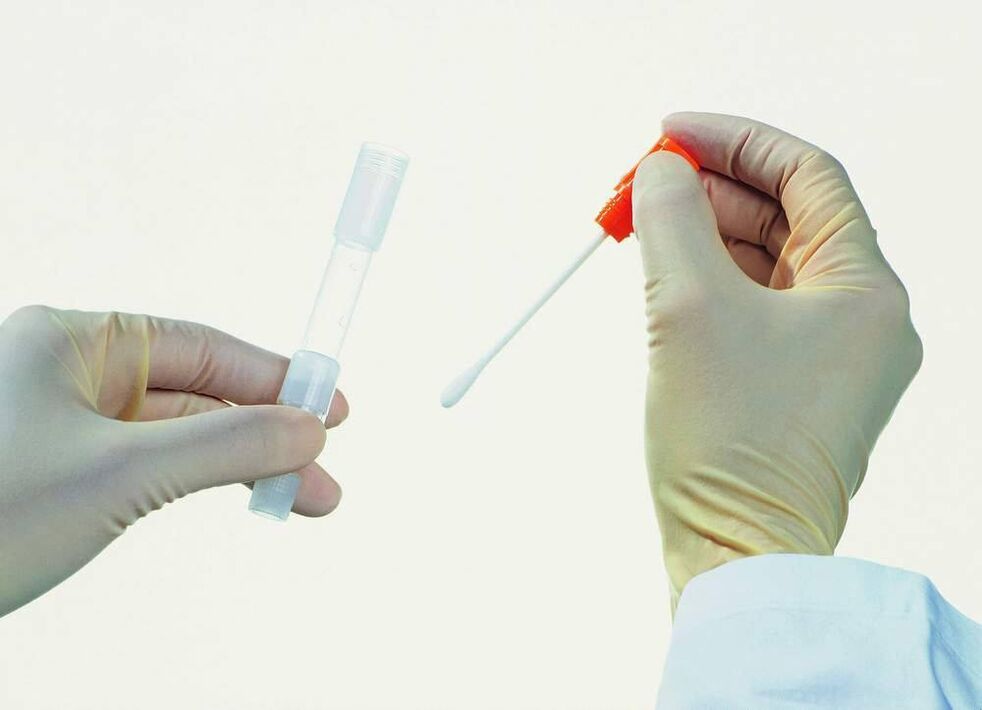An analysis collection to detect chronic prostatitis
