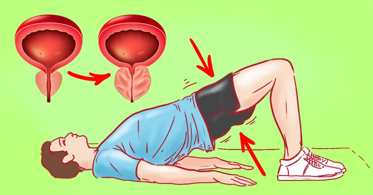 Therapeutic training for chronic prostatitis